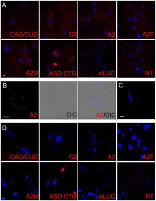 Reduction of Huntington’s Disease RNA Foci by CAG Repeat-Targeting Reagents